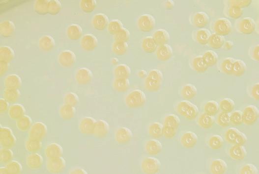 Pseudomonas aeruginosa Ps. aeruginosa are thin Gram-negative motile rods. The bacteria grows with large greyish white/ greenish colonies.
