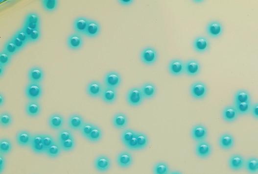Enterococcus faecalis E. faecalis are Gram-positive cocci in short and long chains. The bacteria grows with small green/ greenish blue colonies. 10 3 CFU/mL Close up picture of E.