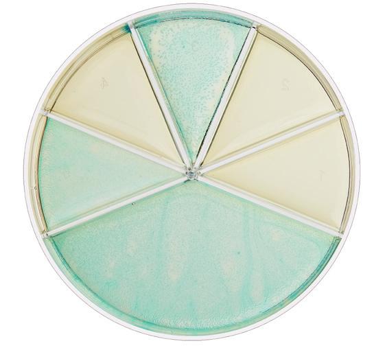Diagnostics The agar plate The agar plate contains a chromogenic substrate, which cau ses bacterial colonies or the agar to appear with different co lours depending on the bacterium species (see