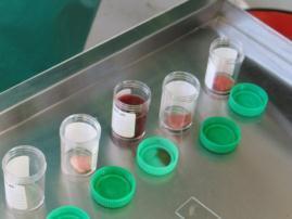 c.) Blood samples "Vacutest" (7ml or 10ml) tubes, containing no preservatives or anticoagulants, must be used and the tubes should be at least half filled with the blood sample.
