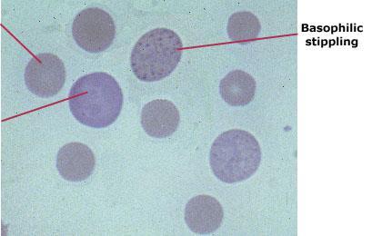 What is Mycoplasma ovis?