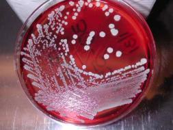 Evolution, Epidemiology, and Eradication of Contemporary Staphylococcus aureus Stephanie Fritz, MD, MSCI Assistant Professor of Pediatrics Washington University School of Medicine