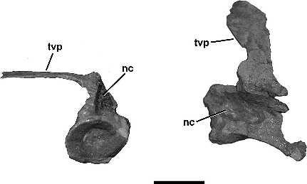 836 JOURNAL OF VERTEBRATE PALEONTOLOGY, VOL. 25, NO. 4, 2005 Skull DESCRIPTION No skull materials can be identified. Axial Skeleton Cervicals The cervical series appears to be entirely missing.