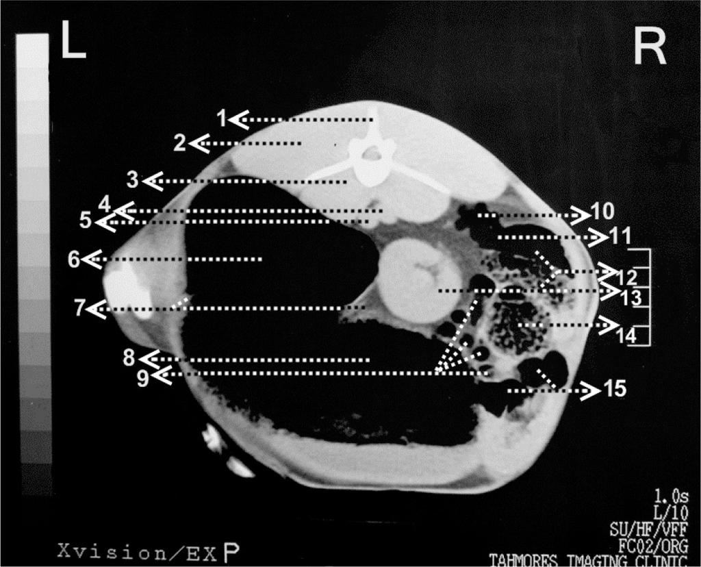 February 2015, Volume 12, Number 1 Figure 7. 1. 1st lumbar vertebra, 2. spleen, 3. aorta, 4. caudal vena cava, 5. dorsal sac of rumen, 6. cranial pillar, 7. ventral sac of rumen, 8.