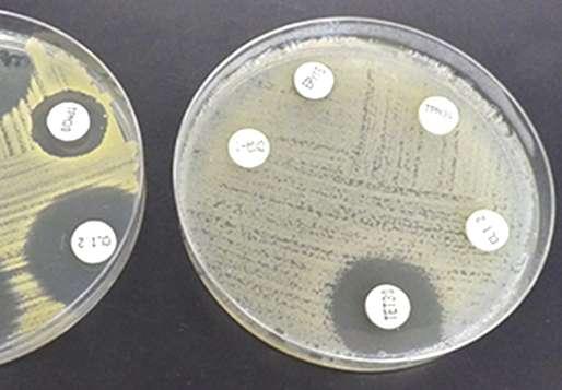 Carbapenem-resistant infections: a challenge