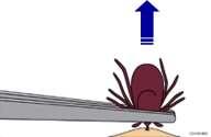 First aid: grasp tick close to head with tweezers. Gently pull upwards and away.