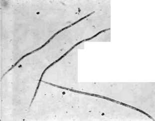 Make a wet preparation (one drop of blood on a slide with a cover slip). Observe under the microscope for movement of microfilariae. b. Perform the modified Knott technique as outlined in the appendix.