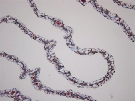 SL: secondary lamellae, : blood capillaries,
