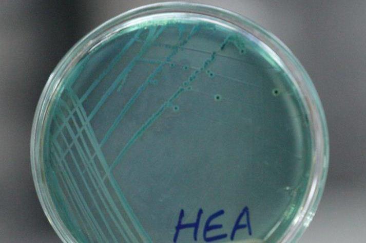 without black center on Hekton Enteric agar at