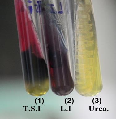 urea agar was yellow Positive result Gas production, H 2 S production, yellow butt (acidic) and