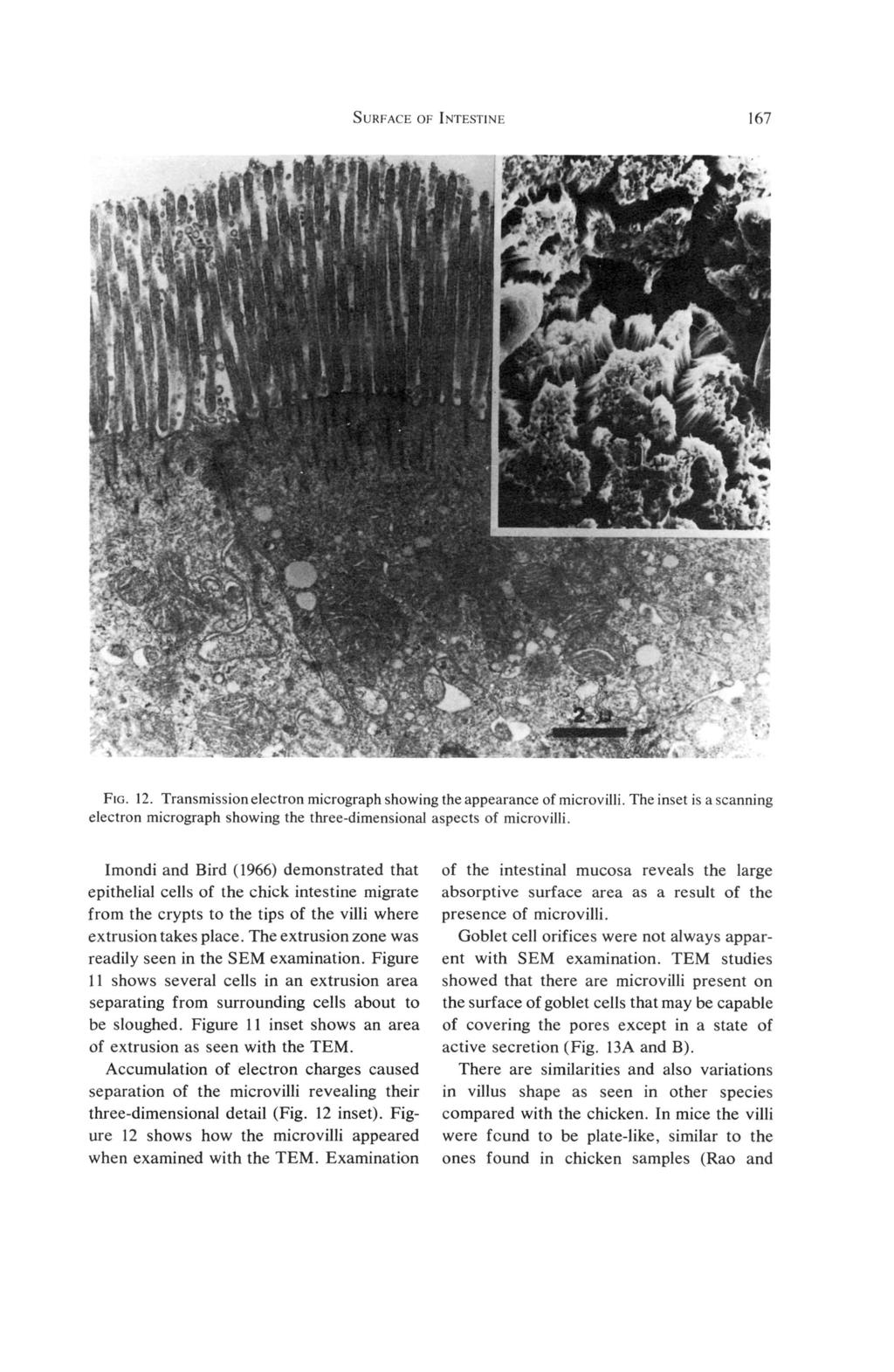 SURFACE OF INTESTINE 167 Hi fvss i,v fegra FIG. 12. Transmission electron micrograph showing the appearance of microvilli.