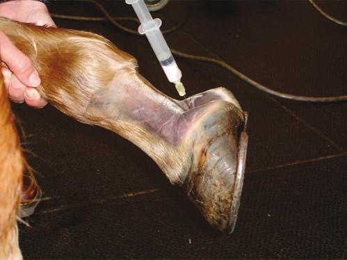 Recently, as a result of deep flexor lesion findings discovered by MRI, treatment of the digital flexor tendon sheath with HA and corticosteroids has been used.