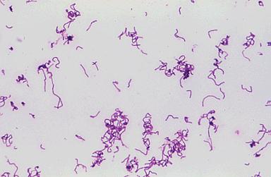 Fermentative Spoilage Lactic Acid Bacteria Lactobacillus Lactococcus