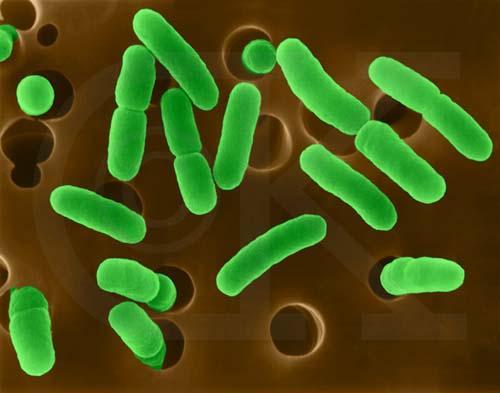 Escherichia coli Occur as normal flora in the lower part of intestine of warm blooded animals Toxin producing strains of E.