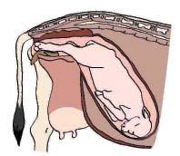 Chapter 4: Pregnancy and Calving Normal fetus position Calving process: 03 stages NORMAL CALF POSITION