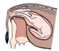 After the delivery of the calf, uterine contraction are still continuing for a period of time.