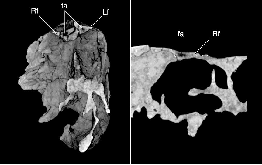 12 AMERICAN MUSEUM NOVITATES NO. 3545 Fig. 8. CT slices of the holotype skull of Tsaagan mangas (IGM 100/1015) showing air spaces in the frontal. Abbreviations are in appendix 1.