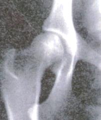 When a dog has hip dysplasia, the ball and socket do not fit smoothly.