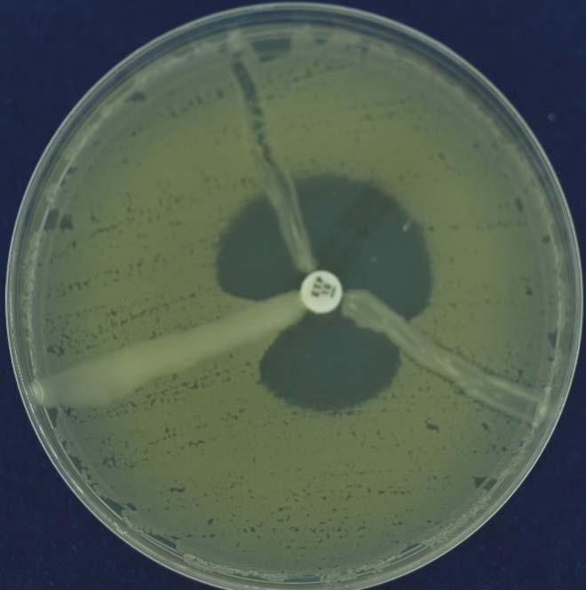 Lab strategies to confirm carbapenemase Modified Hodge test production Create a plate of susceptible E coli Place a