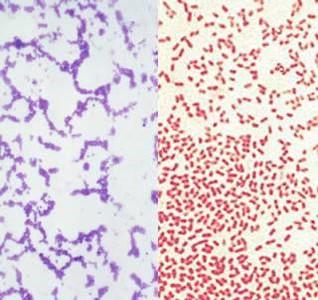 Basics on bacteria Gram Stain Positive (purple) Gram Stain Negative (pink/red) Bacteria have different characteristics that allow us