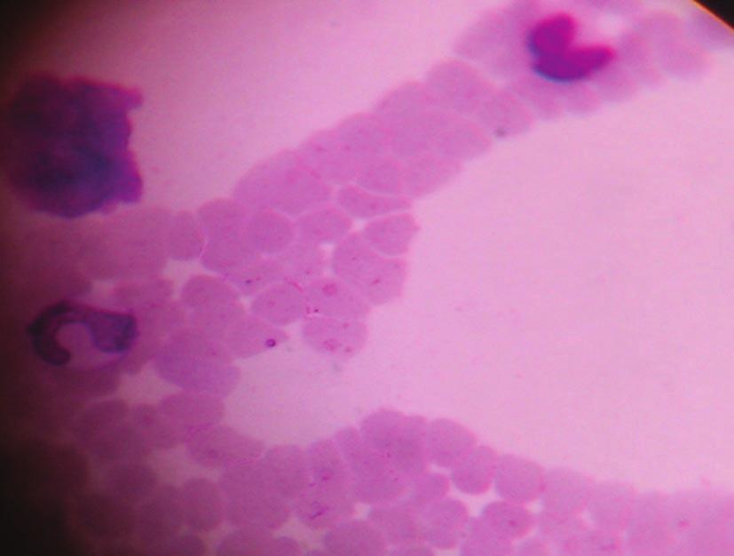 Incidence of Canine Babesiosis in and around Kolkata, West Bengal, India. Fig.1 : Blood smear of dog showing infection of large form canine Babesia spp. Geimsa stained.