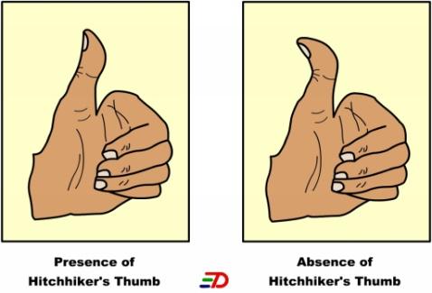 Example: Straight thumb is Dominant to hitchhiker thumb T = straight thumb t = hitchhikers thumb (Always use the same letter for the same alleles NoS =