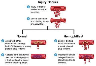 Hemophilia A: X-linked recessive Proteins that cause blood to clot