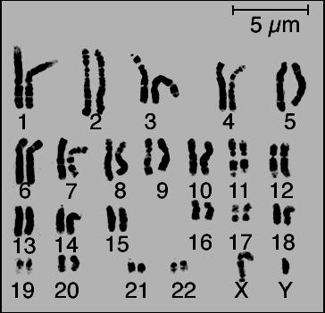 Some Review: Autosomes: Non-sex chromosomes (#1-22