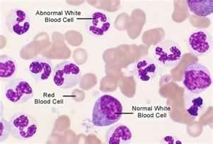 BONESS NEWSLETTER NOVEMBER 2012 Page 3 Normal White Blood Cell Blood under the microscope haematology analyser will give an accurate indication of the composition of your pet s blood in the form of a
