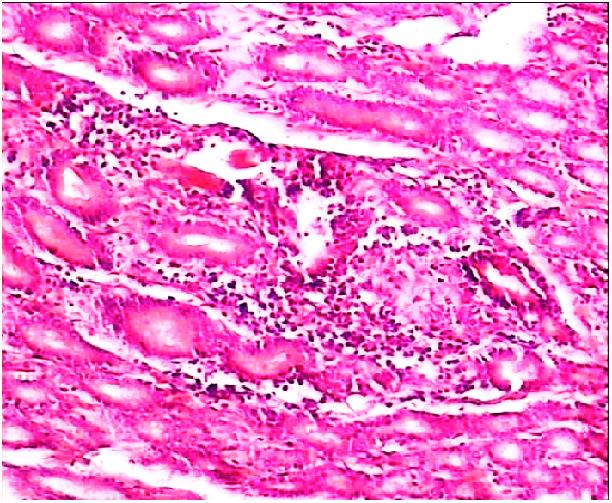 A. Khodakaram-Tafti, A. Hajimohammadi & F. Amiri mostly located in abomasal pylori and bodies. In 9 percent of the abomasa, Cysticercus tenuicollis cysts were found attached on the serosal surface.