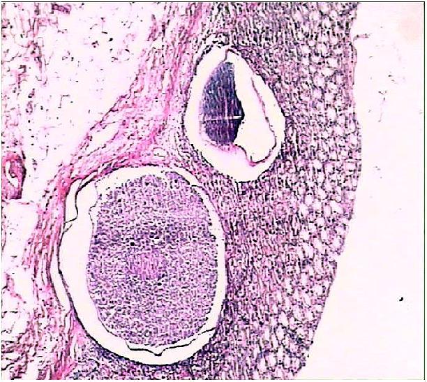Histopathological findings The histopathologic lesions and their prevalence found in the abomasa included osteratagiosis (79%), erosive-ulcerative abomasitis (75%), eosinophilic abomasitis (14%),