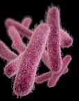 Technical Appendix Drug-Resistant Shigella Methods Estimates of the number of illnesses and deaths from infections with Shigella resistant to azithromycin or ciprofloxacin are reported.