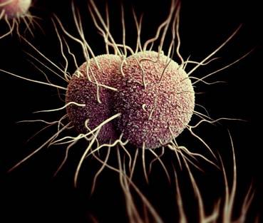 DRUG-RESISTANT NEISSERIA GONORRHOEAE THREAT LEVEL URGENT This bacteria is an immediate public health threat that requires urgent and aggressive action.