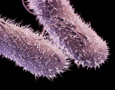 DRUG-RESISTANT NON-TYPHOIDAL SALMONELLA 1,200,000 SALMONELLA INFECTIONS PER YEAR THREAT LEVEL SERIOUS This bacteria is a serious concern and requires prompt and sustained action to ensure the problem