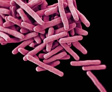 DRUG-RESISTANT TUBERCULOSIS 1,042 DRUG-RESISTANT TUBERCULOSIS CASES IN 2011 (U.S.) 10,528 TUBERCULOSIS CASES IN 2011 (U.S.) THREAT LEVEL SERIOUS This bacteria is a serious concern and requires prompt and sustained action to ensure the problem does not grow.