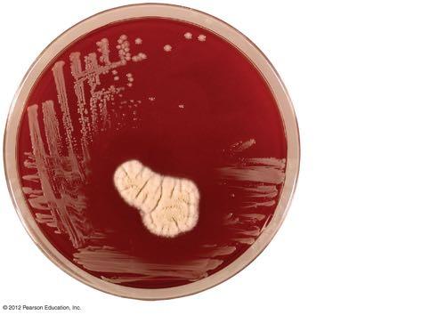 Staphylococcus aureus (bacterium) Penicillium