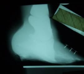 The side bonus of farrier x-rays is detecting related abnormalities that may otherwise be hidden.
