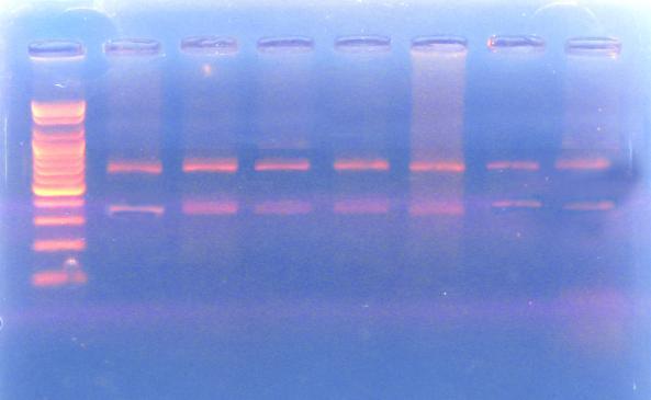 B/ Agarose gel electrophoresis of restriction enzyme Rsa1 on ITS1 gene. L: Ladder (1500bp).