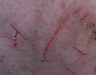 6. Absence of injuries Wounds on body Superficial scratches:
