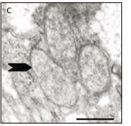 Filarial worm -M (~ 4-5.5 cm) Filarial worm -Y (~ 1.3-2.