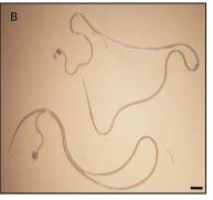 Adult Brugia malayi filarial nematode worms (A & B) and a