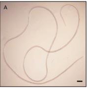 microscopy showing (arrow) Wolbachia endobacteria (C).