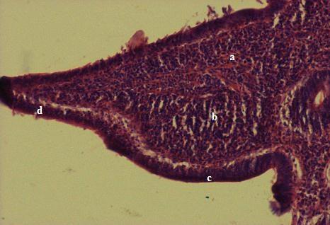 I) showing a) Lymphatic nodule b) Capsule (200 X) Fig 6: Photomicrograph