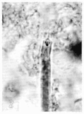 Cephalic hook of D. reconditum. Kodak high-contrast film, X 700. Fig. 6.