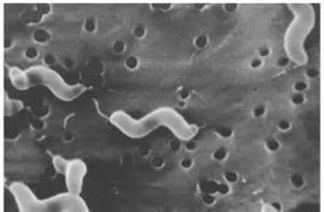 Bacteria: Campylobacter (Vibriosis) C.