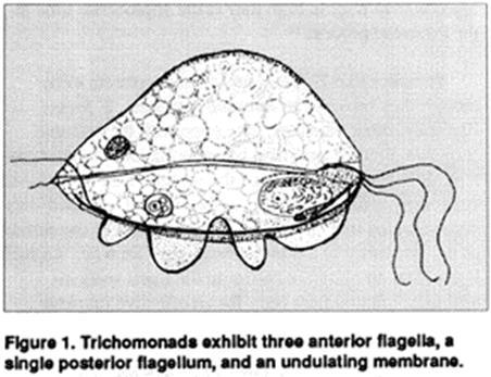 Protozoa: Trichomoniasis Trichomonas fetus
