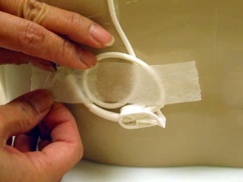 11. Let your catheter and skin dry. While your catheter is drying, remove the new dressing from the package.