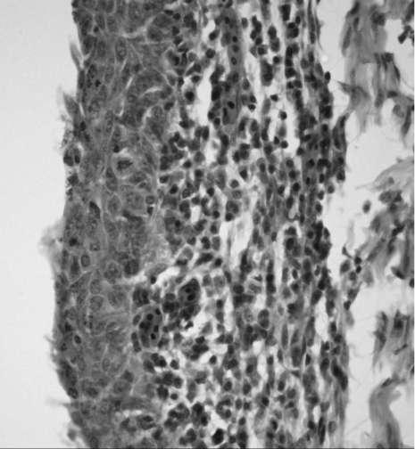 (Figure 6) Figure 6 In histology the normal structure of columnar