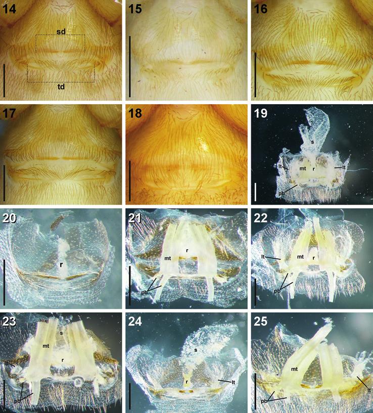 Haddad: Revision of southern African Diplogena 347 Figs 14 25. Digital microscope photographs of female Diploglena genitalia in ventral (14 18) and dorsal view (19 25): (14, 19) D. arida sp. n.