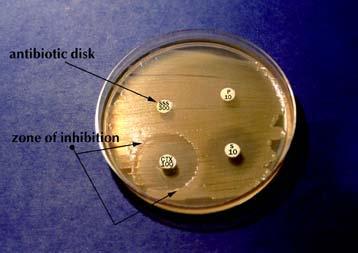 Bacteria growing in a laboratory The